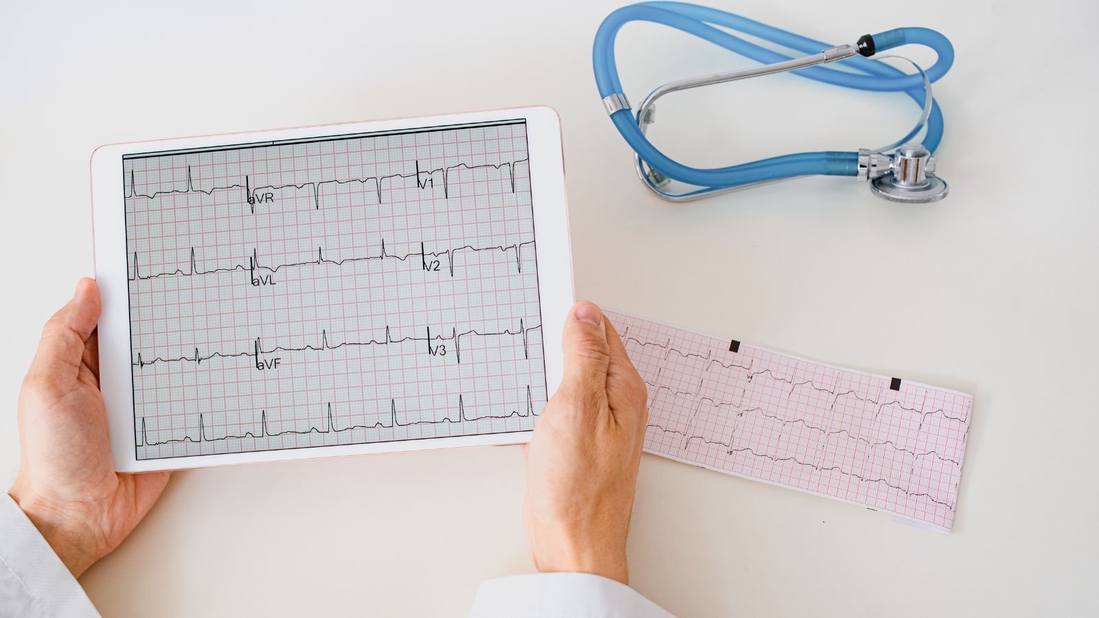 Your Cardiology-Focused CRO for Medical Devices  QbD Group (4)