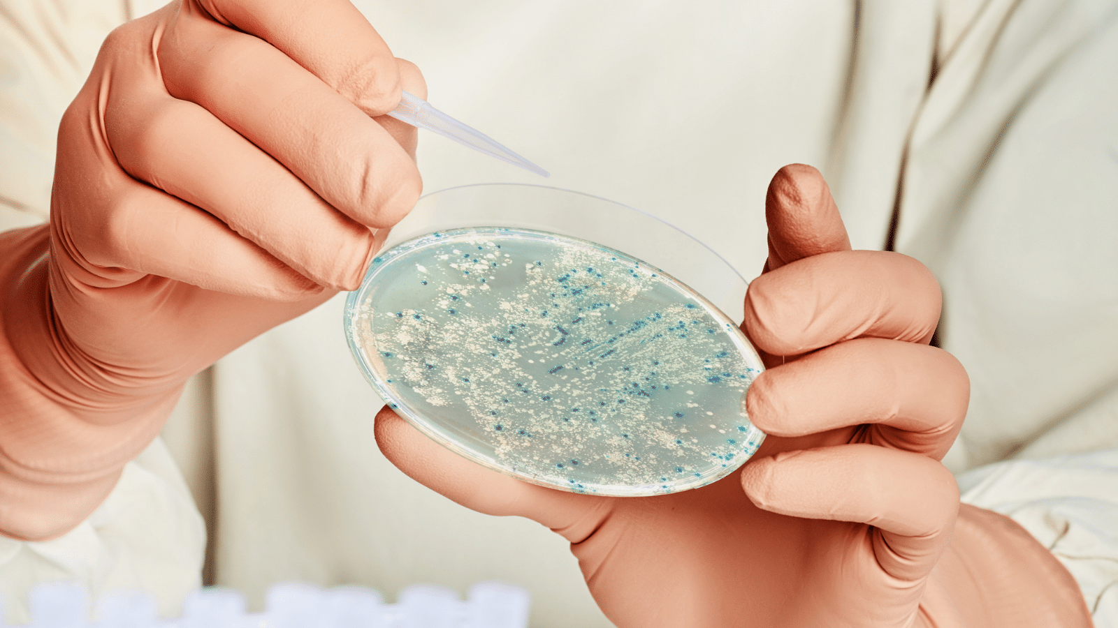 Entender los plásmidos: pequeñas moléculas con grandes implicaciones - Grupo QbD